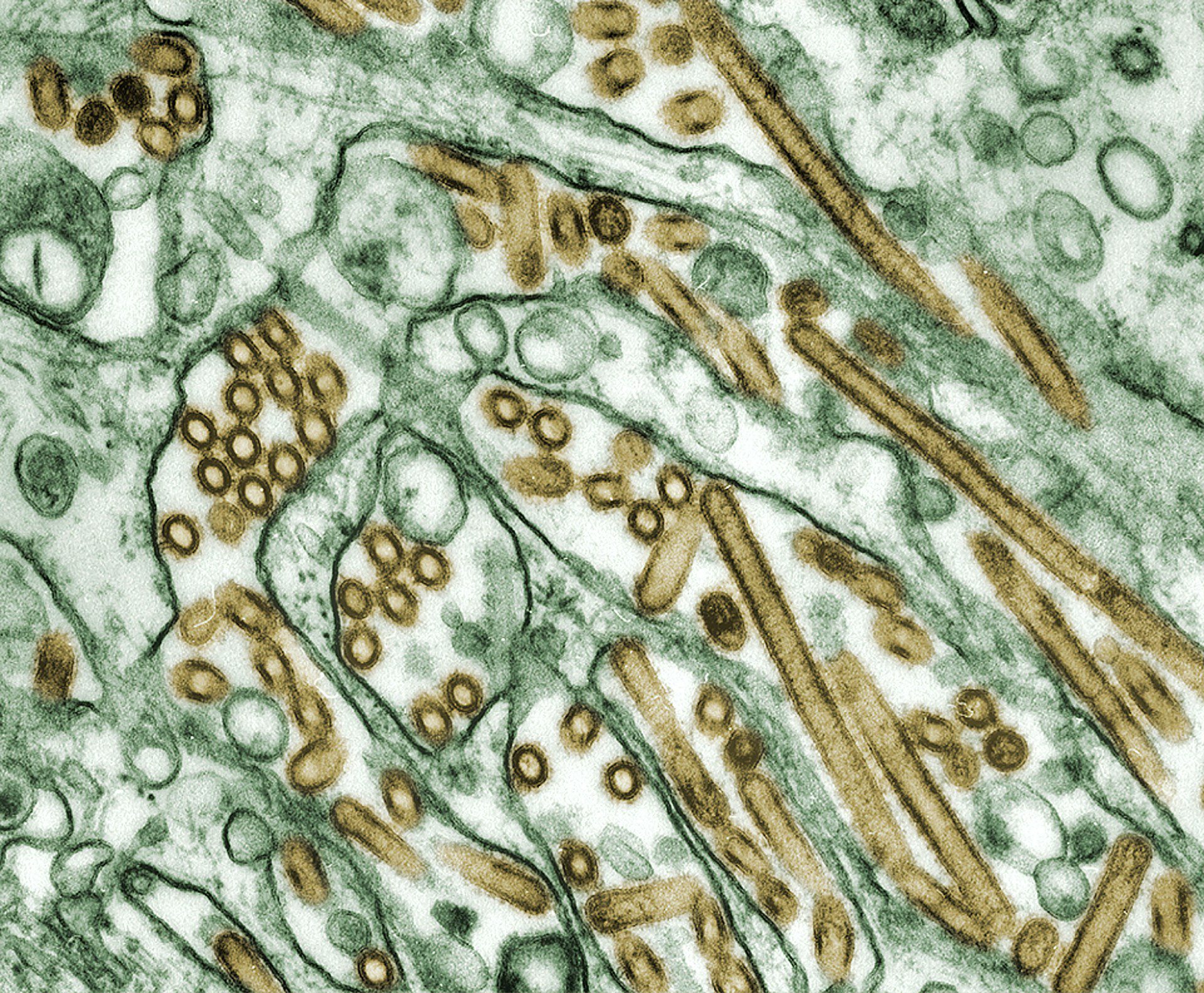Virus strands under a microscope.